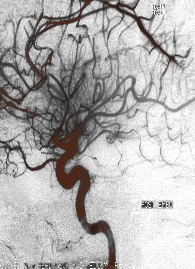 Art: Δήμητρα  Μαλταμπέ,  "States of Mind"